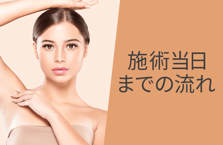 施術当日までの施術の流れ